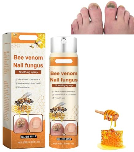 Nagel-Spray Gegen Fußpilz, Bienengift Nagel-Reparatur Spray for Damaged and Discolored Fuß- und Fingernägel, Nagelreinigung und feuchtigkeitsspendende Nagelpflege 20ml (Bee-2Stück)