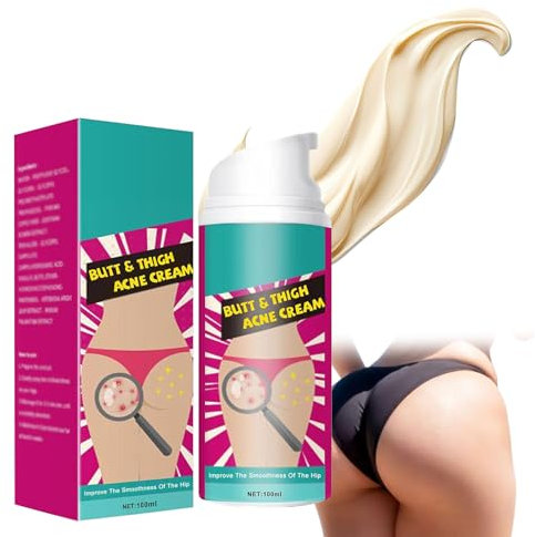 Crema Contro L'acne Per I glutei,Crema detergente per l'acne per glutei,100 ml Cream per i brufoli dei fianchi, Crema di rimozione dei bottoni per i fianchi