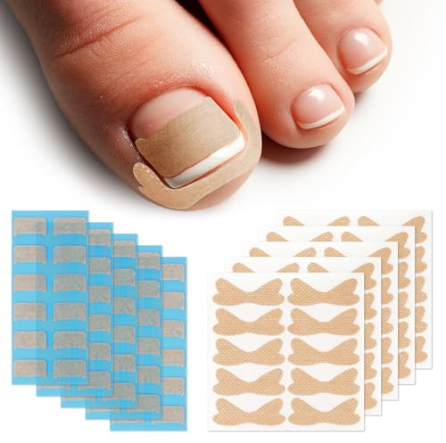 Beugo 110 st nagelkorrigeringsklistermärken, korrigerare för inåtväxande naglar, smärtfria nagelriktningsremsor, lättanvänd verktygssats för inåtväxande naglar