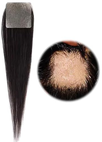 Haarpflaster für den vorderen Haaransatz, Haarpflaster für kahle Stellen, Echthaar-Toupet für Männer/Frauen, zum Abdecken von Haarausfall(3 * 3cm)
