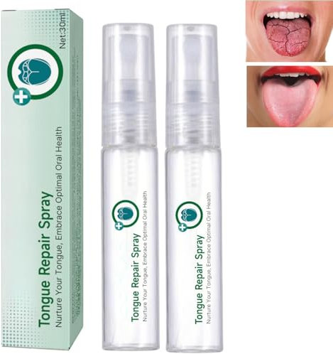 2pcs Tongue Repair Spray,Sore Tongue Relief,Breath Fresheners,Fissured Tongu/e Relief Spray,Tongu/e Moisturizing S/Pray,Instant Dry Mouth R/elief,Mou/th Spra/y for Dryness
