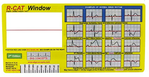R-CAT Carte ECG (ECG) Window. Outil ECG pour Les ambulanciers, Les infirmières et Les médecins