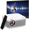 KODAK Kit de proyector Multimedia FLIK X10 Full HD, Mini Sistema de Cine en casa portátil Compacto de 1080p con Pantalla de proyección de 100, Control Remoto