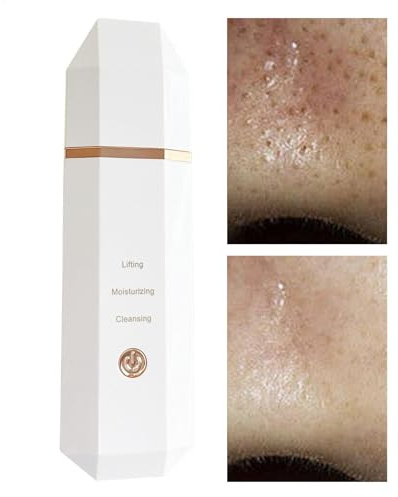 Espátula Facial Limpiadora De Poros Ultrasónica Impermeable Inalámbrica | Removedor De Puntos Blancos Con Espátula Facial Para Limpieza Facial Profunda, Extracción de Poros, Absorción d