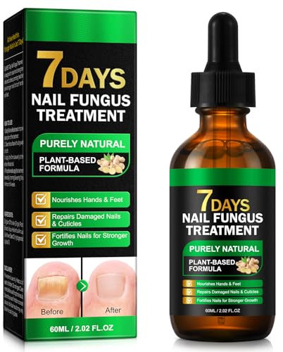 7 giorni Nail Fungus Treatment, Ginger Nail Growth Siero naturale per unghie con zenzero, jojoba e olio di girasole | Ripristina unghie danneggiate, cura antifungina per unghie e piedi, 60 ml
