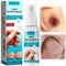 Skin Liquid Plaster Spray,Liquid Plaster,Waterproof Plasters for Wounds,Waterproof Breathable Plaster Spray,Liq-uid Pla-Ster for Wounds,WOU-nd Care Li-Quid SPR-ay,Dressing for Protection Film