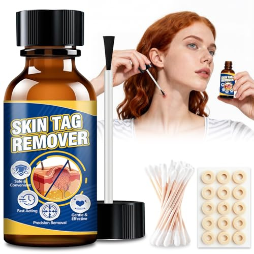 HuakChai Liquide Verrue Plantaire, Liquides de 20 ml pour Acrochordons Élimination Efficace, Dissolvant Extra fort Pour Lesanti Verrue, Liquid pour Anti Verrue Plantaire des Pieds, Mains