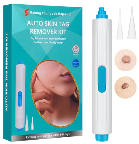 FLETUTE Skin Tag Removal Kit - Sanftes CryoTag-Gerät mit Präzisions-Applikator, schmerzfreie Lösung für zu Hause für Frauen, sicherer Hautmarken-Entferner & Tag Buddy System