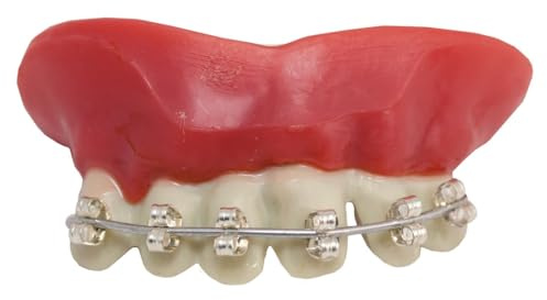 Dentier appareil dentaire