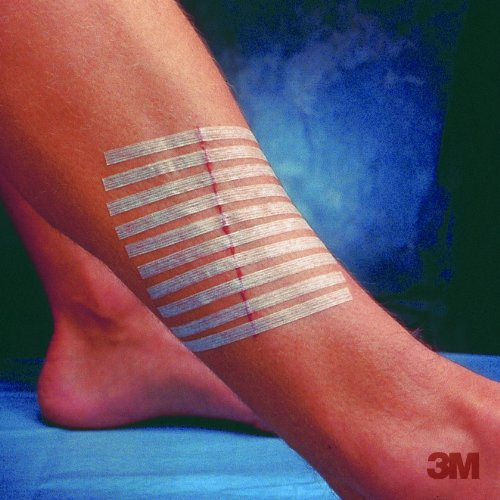 Steri-Strip 3M Reinforced Skin Closures Strip Envelope, 10 Count