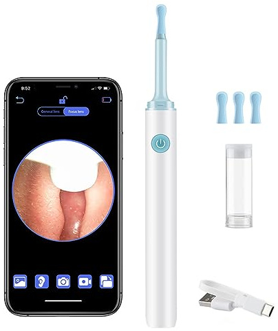 Otoscopio Limpiador Oidos, LANMOU 1944P Wifi HD Limpiador de Oidos Cera con 6 LED y 4 Cucharas de Silicona, Carga USB, Kit de Limpieza Visual de Oídos Para el Cuidado Familiar, Blanco