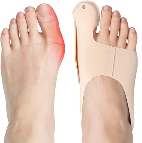 flintronic hallux valgus korrigering, 1 par tåspridare hallux valgus korrigeringsset, hallux valgus bandage för män och kvinnor, mjuk och andningsaktiv för dag och natt (hudfärg, L)