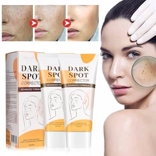 Tkekruh 2PC Crème Blanchissante 60ml, Whitening Creme, Crème Anti-taches de Rousseur, Creme Visage Anti Taches, Blemish Whitening Cream, Crème éclaircissante aux taches de rousseur, Reduziert Dunkle