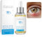 Stye Eye Treatment 30ml, LA.PERSONAL Siero Blefarite Occhi, Lenitiva Rapida, Orzaiolo Occhio Cura per Calazio e Occhi Sensibili, Detergente Palpebre per sollievo irritazioni e gonfio, uomini e donne