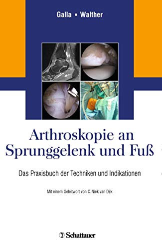 Arthroskopie an Sprunggelenk und Fuß: Das Praxisbuch der Techniken und Indikationen