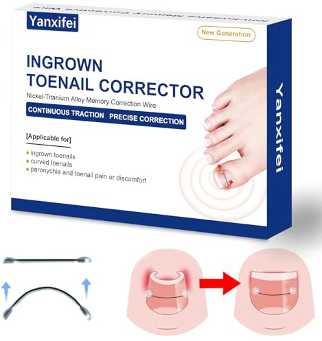 Corrector de uñas encarnadas Nitinol, tratamiento de uñas encarnadas en casa, enderezador de uñas curvadas, alivio de uñas encarnadas, kit de eliminación de uñas encarnadas (12,7 mm, 17,5 mm)