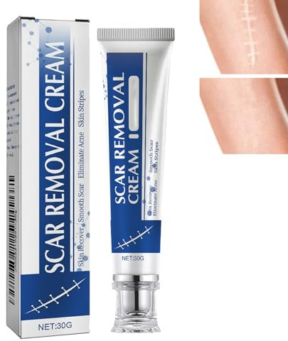 KOAHDE Gel di Cicatrice in Silicone,Gel Riparatore di Cicatrici,Eliminazione Di Cicatrici,Crema Eliminatore Di Cicatrici,Crema Anti Smagliatore,Crema per Eliminare le Cicatrici,30G