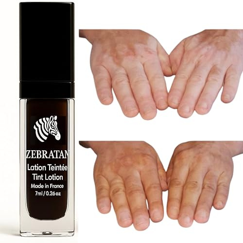Skräddarsydd Zebratan Vitiligo Makeup - 7ml Light Beige - Camouflage Places - självbrun lotion - fettfri, ingen foundation