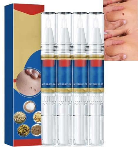 4 PCS Wart Remover Pen,Tags and Mole Remover Pen,Au/to Wart Tag Remover Pen Kit,2 in 1 Wart and Wart Treatment Pen,Natural Wart Remover Pen for All Skin Types,Fast Effective W/Art Rem/Over P/en