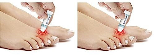 Maximex Hühneraugen und Hornhautstift, antibakterielle & antimykotische Wirkung, beugt schmerzhaften Druckstellen, Hühneraugen & Fußpilz vor, Naturprodukt ideal für unterwegs, 5 g (Packung mit 2)