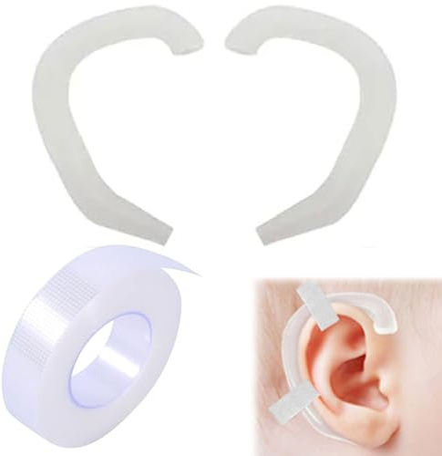 Set di Patch di Correzione del Padiglione Auricolare per Bambini Cerotti Orecchie a Sventola Correttore Orecchie Neonato Cerotti per Orecchie a Sventola 1.25x900CM