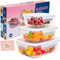 Glass Food Containers With Lids, Meal Prep Glass Food Storage Containers With Lids,BPA Free, Stackable, Leakproof,High Temperature Resistance for Microwave, Oven, Freezer and Dishwasher, 3 Pieces