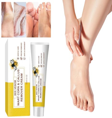 Bienengift Fußcreme gegen Hornhaut und Hühneraugen – Creme für sehr trockene Füße, intensive Anti Hornhaut Creme & Schrundensalbe für rissige Fersen, Fußpflegecreme zur Pflege bei Warzen, 15g