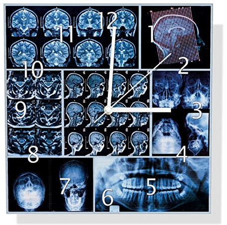 Wallario Design Wanduhr Röntgen-Bilder eines menschlichen Kopfes von Allen Seiten aus Aluverbund, Alu-Uhr Größe 30 x 30 cm, weiße Zeiger mit Metalloptik