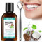Aceite Blanqueador, Enjuague Bucal Con Aceite De Coco, Enjuague Bucal Con Aceite Blanqueador Natural, Mezcla Premium De Limpieza Y Reducción De Placa De 4.2Onzas Líquidas, Elimina El Sarro Y La Placa