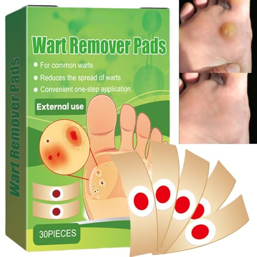 30pcs for Verruca Treatment & Corn Removal,Pain Relief Wart Plaster,Plantar Wart Remover for Hands, Feet,Corn Plaster with Hole for Feet,Wart Remover,Corn Remover for Feet and Hand,Verruca Treatments
