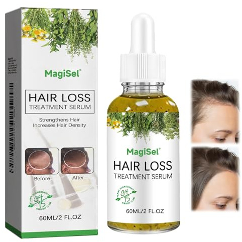 Serum hårväxt, Hair Growth Serum, rosmarinolja för hår, ger näring åt hårläder, anti-håravfall, lämplig för män och kvinnor, 60 ml