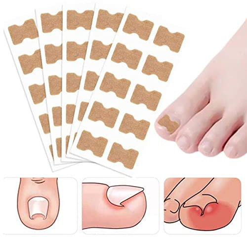 50 Stück kleberfreie Zehennägel Zehen eingewachsene Nägel Korrektur Patch Nagelaufkleber Fußpflege Nagelkorrektur Aufkleber für Männer Frauen