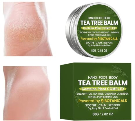 Crème Anti-Démangeaison 80g Baume Pieds Hydratant Nourrissant Non Gras