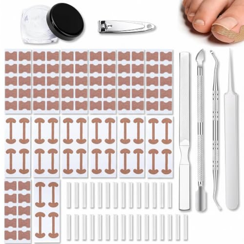 SINAYREK Set Unghie Incarnite, 161 Pezzi Cerotto Correzionale Unghie, Correttore Pedicure, Strisce Unghie Incarnite, Set Completo Cura Piedi Acciaio Inossidabile