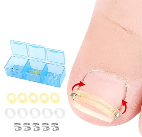 Ingrown Toenail Corrector, Stainless Steel Curved Toenail Straightener with Rubber Bands, Ingrown Toenail Removal Kit, Professional Ingrown Toenail Pedicure Tools for Men Women Curved Nail Repair