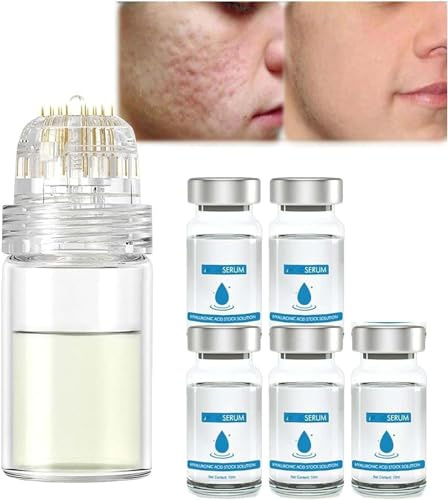 Mikro-Infusionssystem für Lippen, Mikrosystem für Gesicht, Gesichtsbehandlung mit Serum, PockmarksHeal Mikronadel-Roller mit Hyaluronsäure, Serum für glatte Haut, 5er-Set
