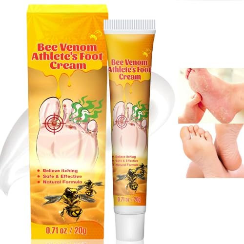 Athletes Foot Treatment,Anti Fungal Skin Cream,Itch Relief Cream,Foot Cream for Very Dry Feet,Toenail Fungus Treatment,Ringwor Antifungal Cream,Cream for Itchy Skin,Itching Cream for Feet,Foot Care