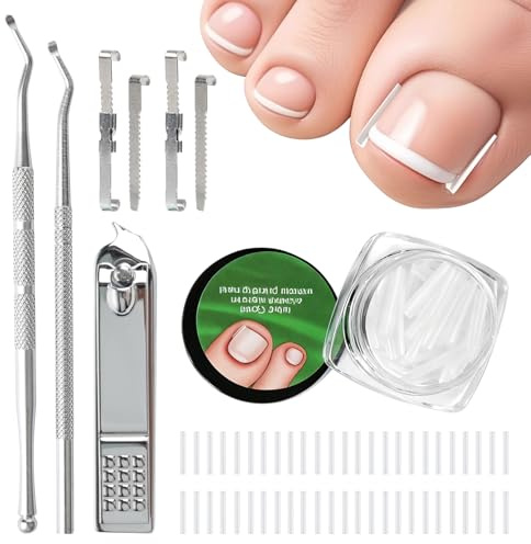 100 stycken vuxna tånaglar plåster + nageltång + 2 nagellyftare + 2 nagelklämmor | set för korrigering av inåtväxta tånaglar – smärtfri och effektiv