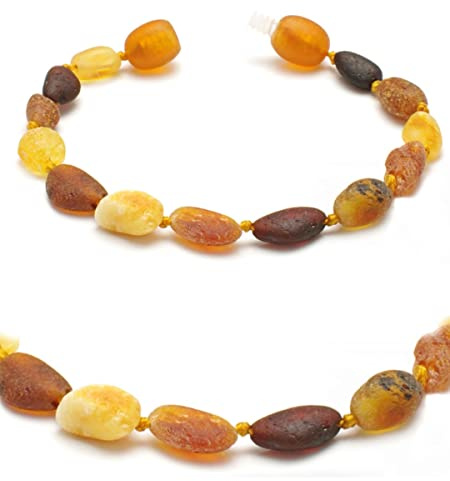 Baltic Secret Selected Baltic Amber Bernstein kette - Heilsteinkette - echt Bernstein Schmuck - Halskette als Geschenk für Damen & Herren, Natürliche Schutzstein - Glücksbringer