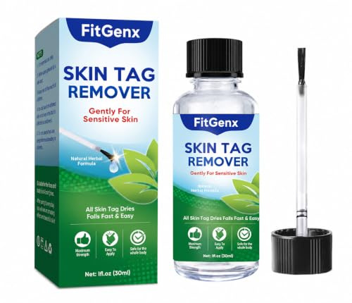 Stielwarzen Entferner, Warzenentferner zum Vereisen, 30 ml | Schnelle Entfernung von Warzen und Hautanhängseln, sanft, schmerzfrei, einfach anzuwenden und für empfindliche Haut geeignet