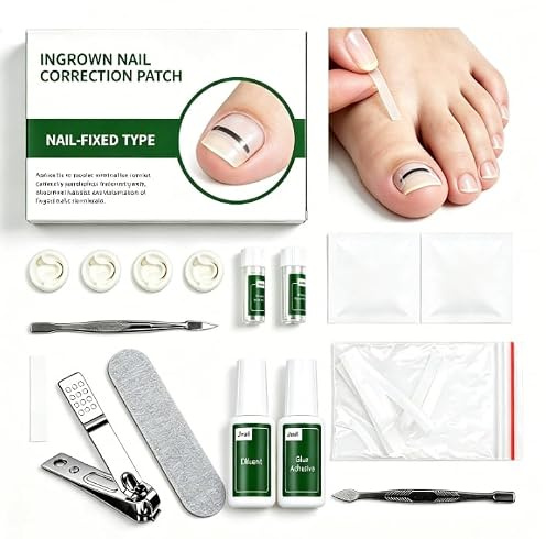 Kit Unghie Incarnite Piedi 10 Pezzi, Correttore Unghia Incarnita Alluce in Acciaio Inossidabile e Plastica, Strumento Portatile per Pedicure e Prevenzione Onicomicosi, Comodo e Pratico da Usare