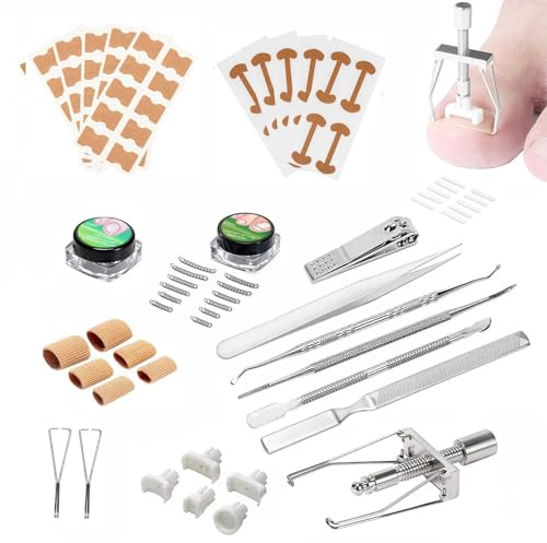 Unghie Incarnite Kit, Correttore Dell'unghia Incarnita Strumenti per Unghie dei Piedi Incarniti Set Unghie Incarnite Strumento per Unghie Incarnite la Cura Dellunghia del Piede