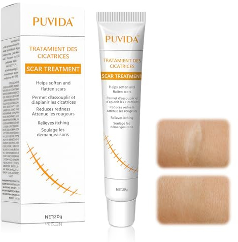 20g Crema Para El Cuidado De La Piel, Tratamiento De Cara Y Cuerpo, Crema Para Estrías, Mejorar El Aspecto La Piel, Apto Todas Las Partes Del Cuerpo.