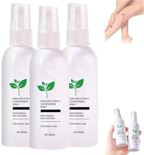 Spray acondicionador de extracto de verdolaga, spray profesional para tratamiento de venas varicosas para piernas, potentes aerosoles para venas varicosas para un alivio eficaz de las venas varicosas