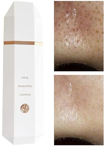 Furtryvl Espátula de limpieza profunda para la piel, espátula ultrasónica, removedor de puntos blancos, impermeable, inalámbrico, recargable, para limpieza facial profunda