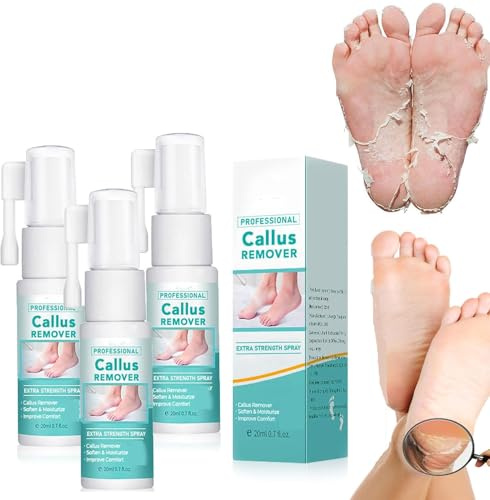 Spray professionale per la rimozione dei calli extra forte, spray per la rimozione dei calli dei piedi, spray per rimuovere calli e talloni, olio spray per rimuovere la pelle morta e i calli sui piedi