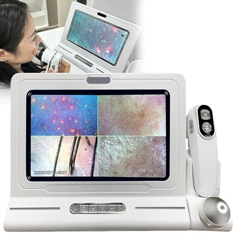 oiakus Kopfhautdetektor, 11 -Zoll -HD -Scalp -Detektor -Mikroskop für Kopfhaut/Haarfollikel -Hauttests -Smart Analysis, 50x 200x Vergrößerung
