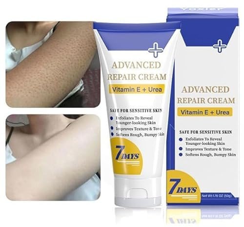 Keratosis Pilaris Treatment, Keratosis Pilaris Moisturizing Cream, Strawberry Legs Treatment Body Scrub for Women, Rough Bumpy Skin Body Lotion, Remove Hard Lumps Dry Rough Body Skin Care