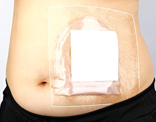 GEDRACKPMYN wasserdichte Stomabeutel-Duschabdeckung, 30 Stück Stoma-Bad Schutzfolie, Selbstklebende Verband Binde (10 x 12) cm