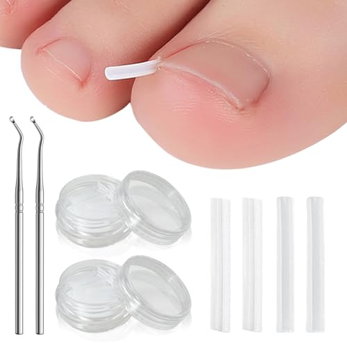 UILYNIU 102 Piezas Corrector Uñas Encarnadas, Herramientas de Uñas Encarnadas, Corrector Uñas con Levantador De Uñas Encarnadas, Corrección de Uñas de Los Pies para Uñas Encarnada (Transparente)